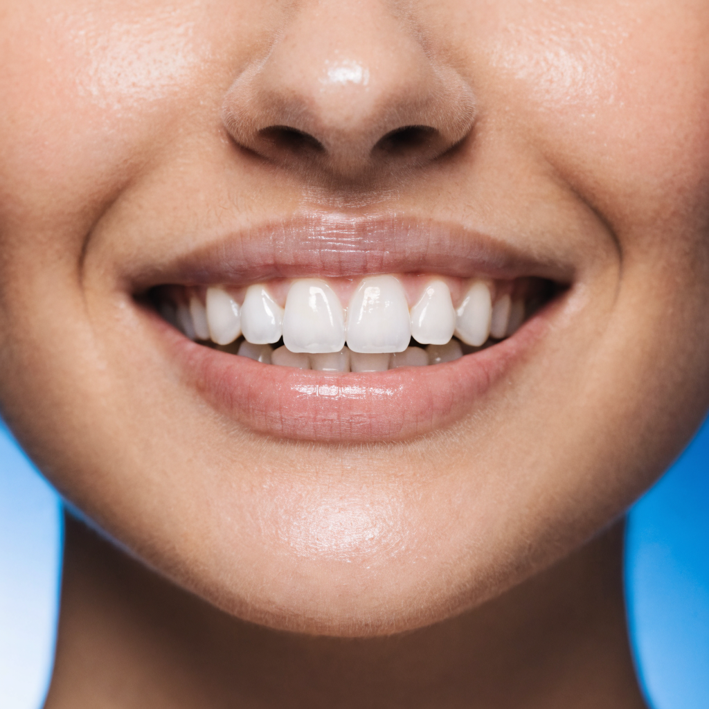 Blanqueamiento dental: mitos y verdades que todo paciente debe conocer